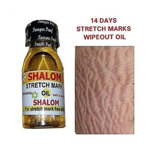 Shalom 14 Days Stretch Marks Wipeout Oil